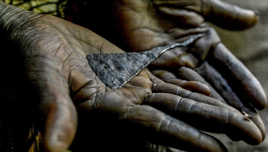 Sudão prepara-se para criminalizar mutilação genital feminina