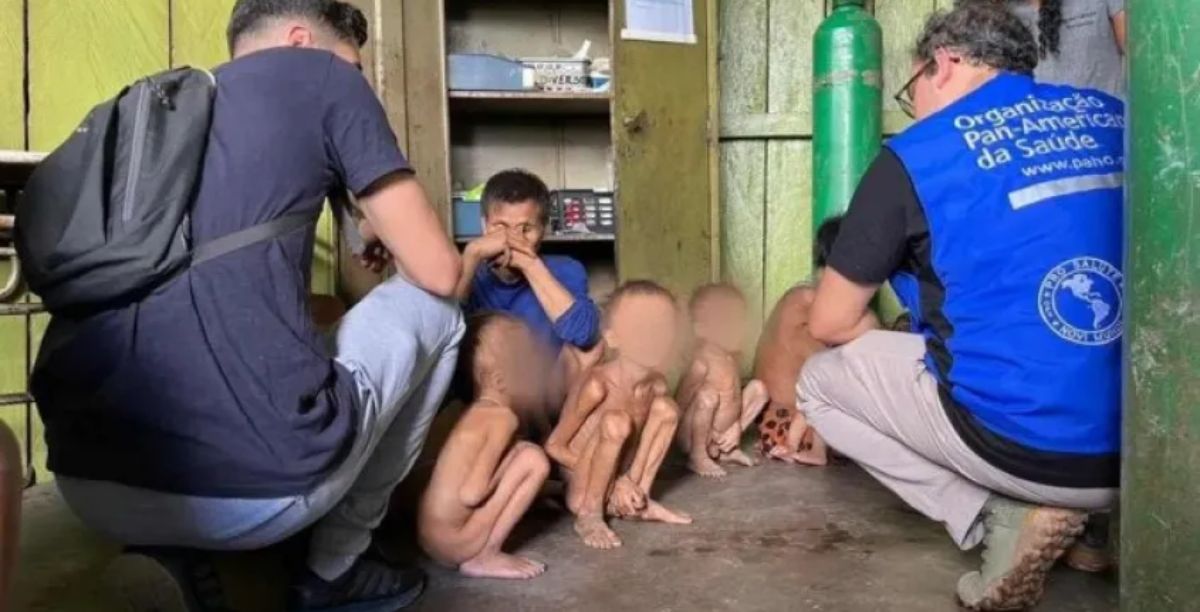 crianças desnutridas do povo yanomami, no brasil, foto Condisi-YYDivulgação (1)