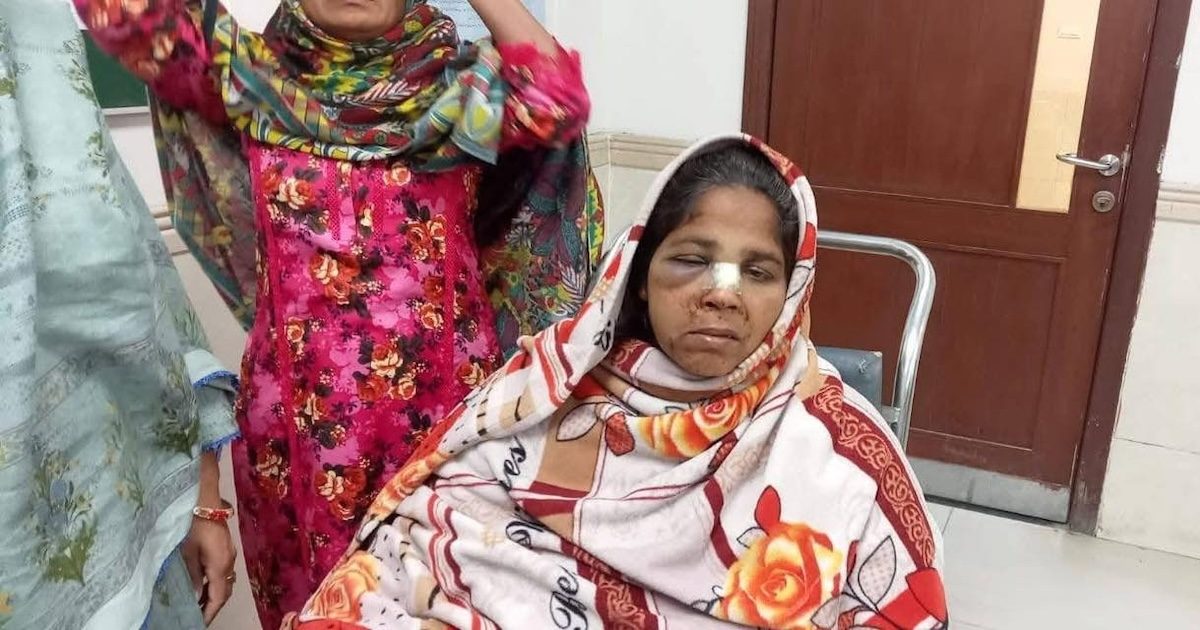 Uma mulher ferida após duas centenas de fiéis que iam em procissão terem sido atropelados por um camião nas ruas de Gujranwala, no estado do Panjabe, no Domingo de Páscoa, 5 de abril. Foto: Direitos reservados.