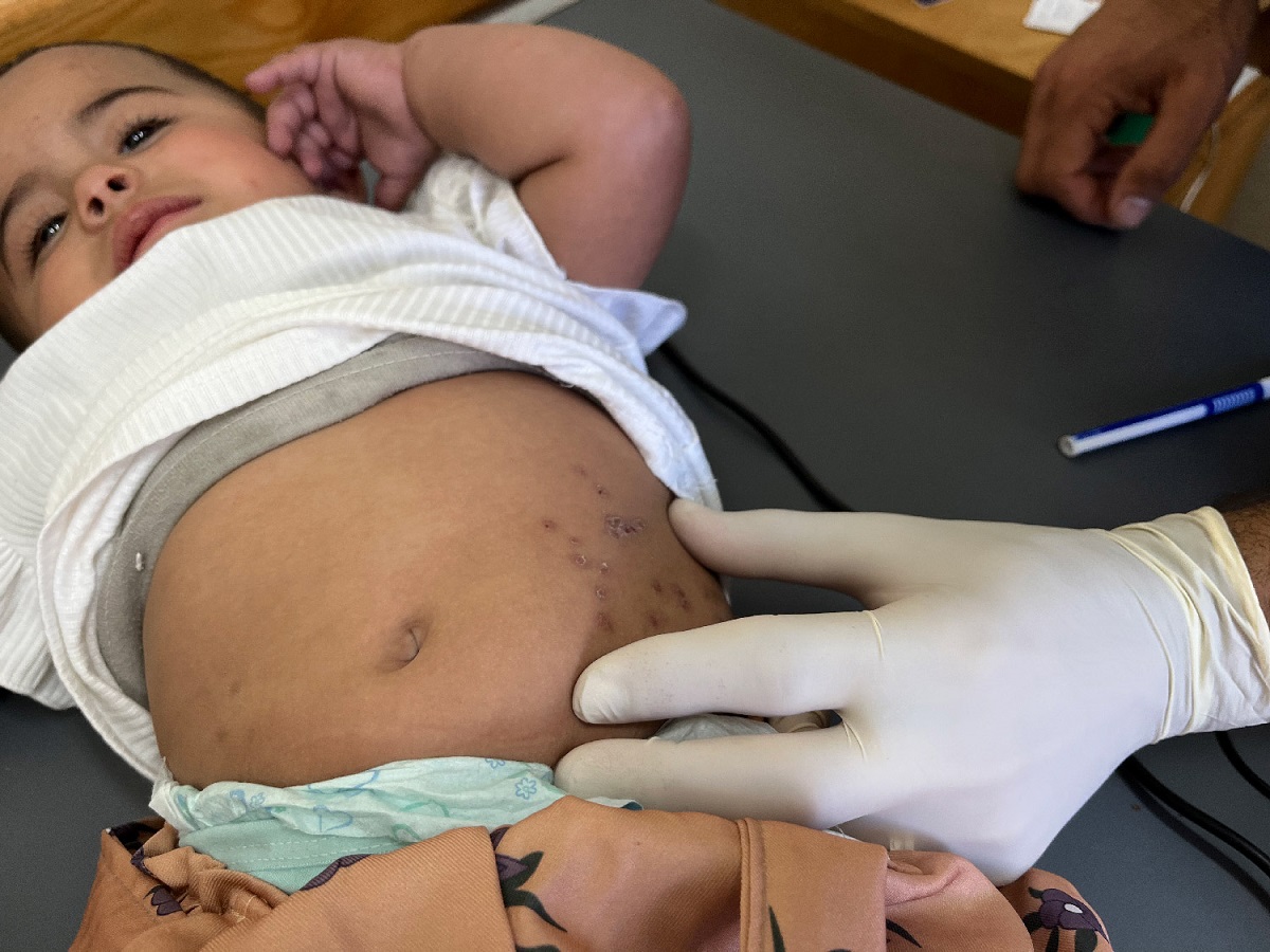 Gaza. Cuidados de Saúde