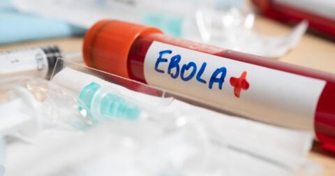 Virus ebola. Foto Brightstars